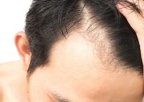 How To Choose The Right Hair Transplant Center In Turkey?