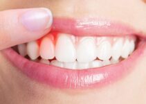 How Plaque And Gum Disease Affect Your Health