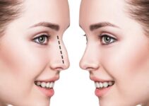 Health Motivated Reasons to Consider a Nose Job