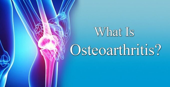 What is Osteoarthritis and What Can You Do to Manage It?