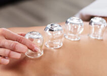 How Often Should You Have Cupping?