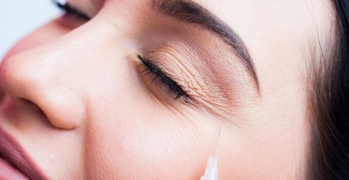 Newtox vs Botox – What Are the Differences?