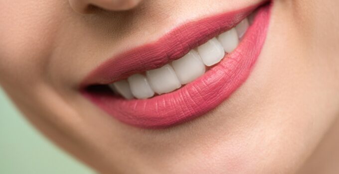 A Good Dentist: The Key To A Beautiful Smile In 2024
