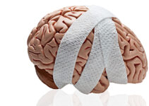 Brain Injury Rehabilitation: What Should You Expect?