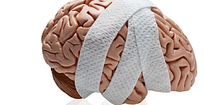 Brain Injury Rehabilitation: What Should You Expect?