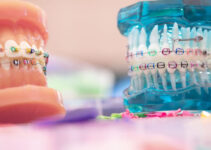 8 Things to Know Before Hiring the Best Orthodontist