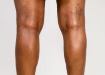 How to Locate Veins on Dark Skin Using Vein Finder