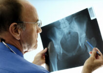 Top Advances in Orthopedic Medicine