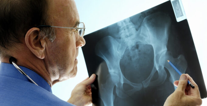 Top Advances in Orthopedic Medicine