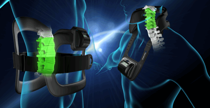 PEMF of Bone Healing