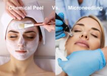 Microneedling vs. Chemical Peels: Which Rejuvenation Method is Right for You?