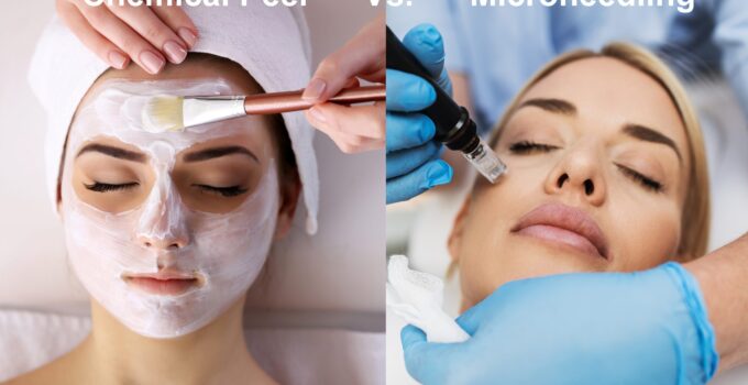 Microneedling vs. Chemical Peels: Which Rejuvenation Method is Right for You?